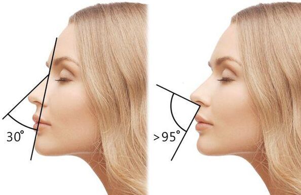mesure de l'angle du nez