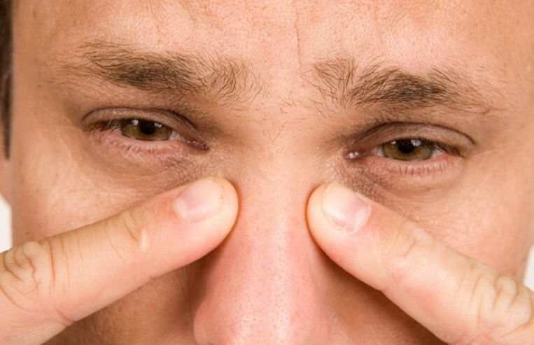 La douleur nasale persistante est une complication grave de la rhinoplastie